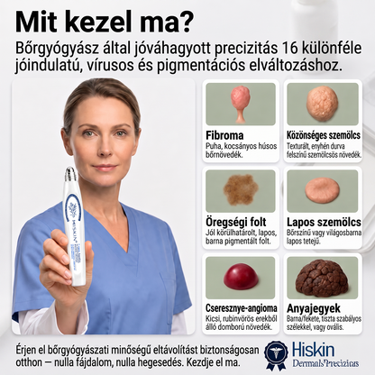 👑Hivatalos Márkabolt | 🚢🚢 Hiskin® 7 napos Szemölcseltávolító Roll-on Ápoló Folyadék (Fájdalommentes rollerball technológia, hegek nélkül) 🐬