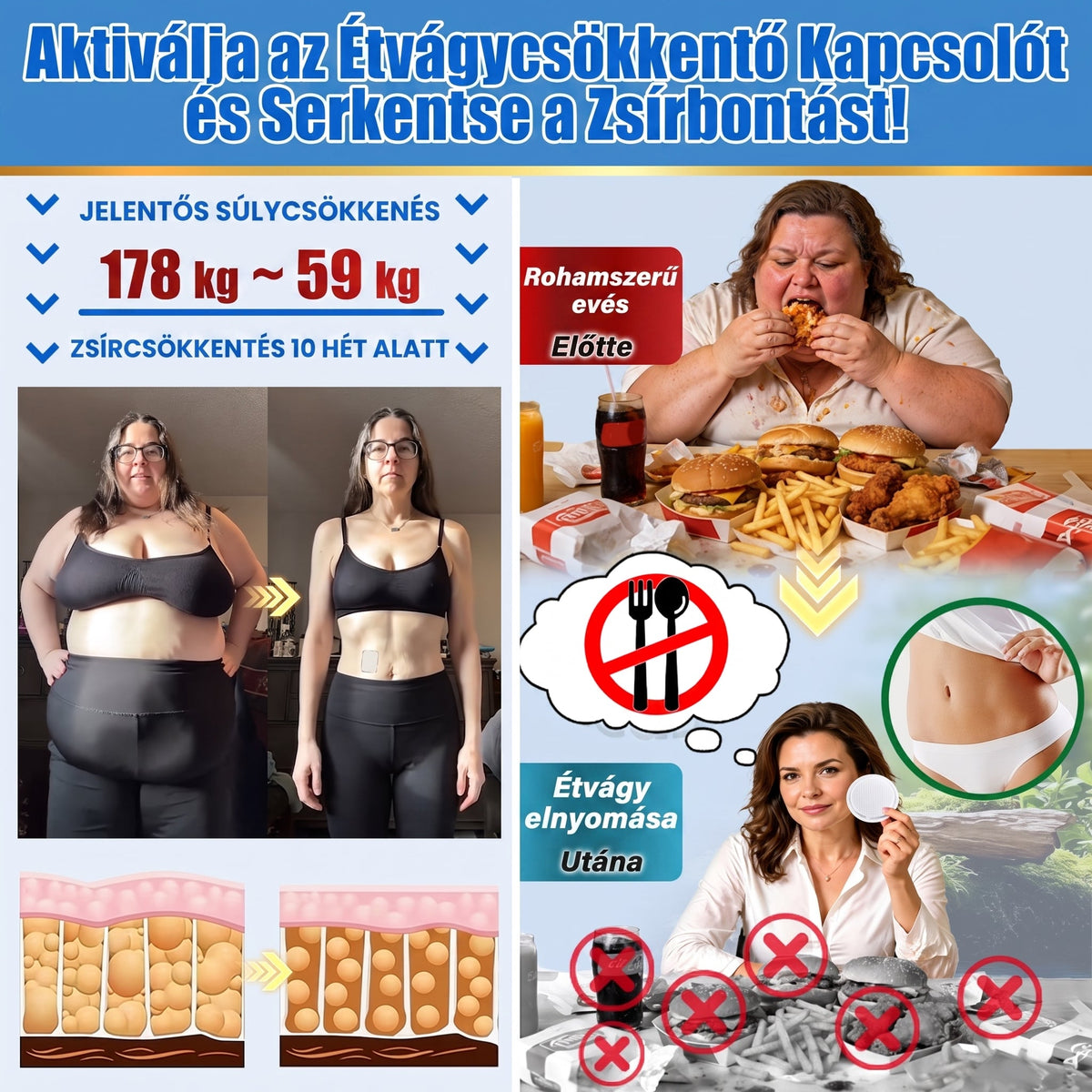 FFBSI® upsell