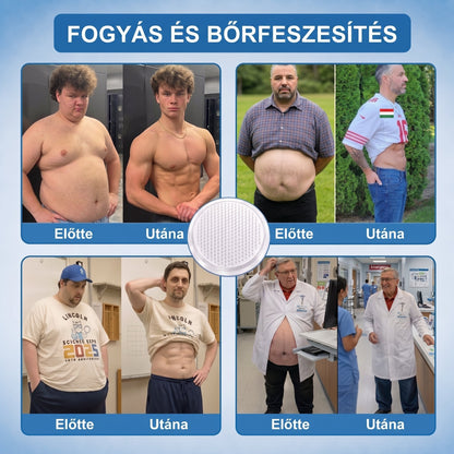 FFBSI® upsell