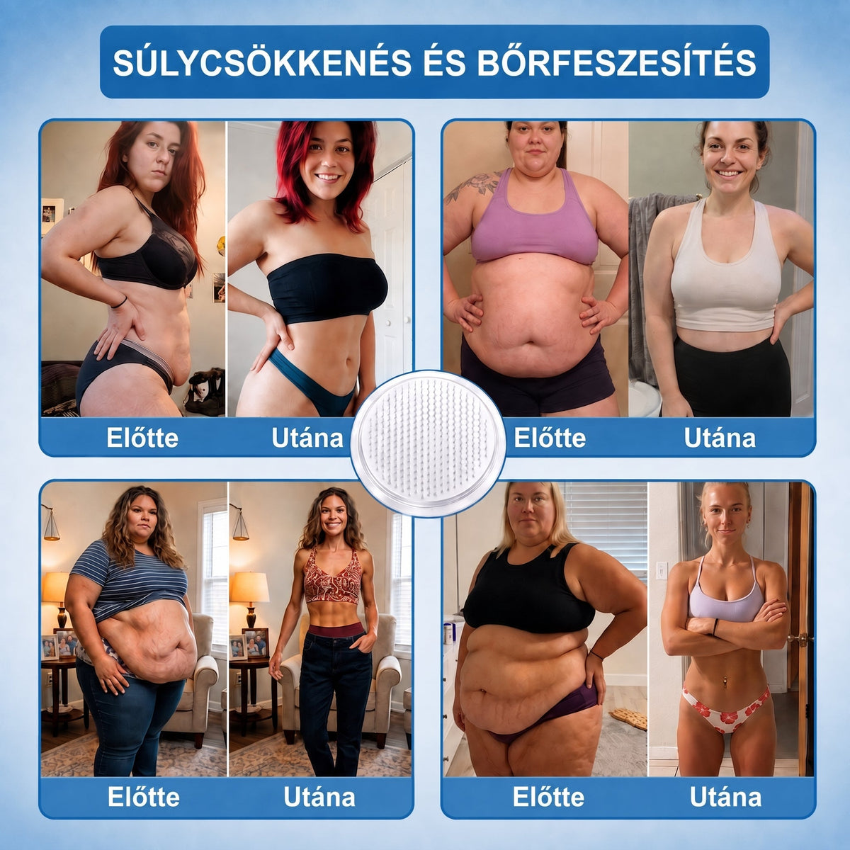 FFBSI® upsell