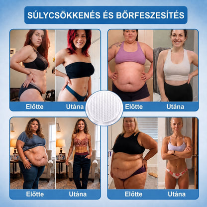 FFBSI® upsell
