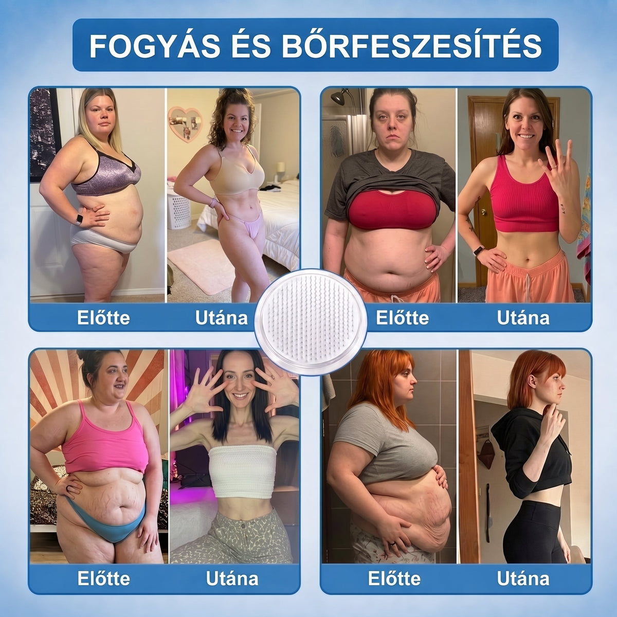 FFBSI® upsell