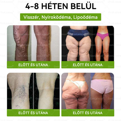50% KEDVEZMÉNY ❤️ GeeLemon® Glumasetide 8 az 1-ben Nano Mikrotűs Tapasz | Moringa · Berberine · NAD+ | Napi 1× | Csak most!
